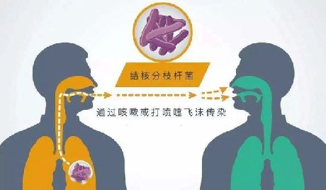 预防肺结核，请牢记这几招！